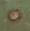 Urchin