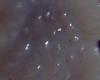 Lithodid Crab - Paralomis africana