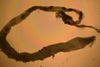 Capitellidae sp.