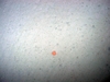 Anthozoa