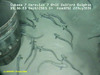 Eelpout
