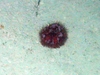 Phormosoma placenta